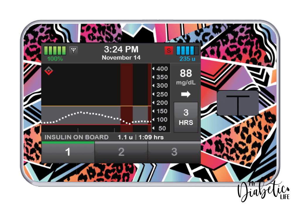 80s Baby - Tandem Tslim x2 Pump Peel, skin and Decal, insulin pump sticker - MyDiabeticLife