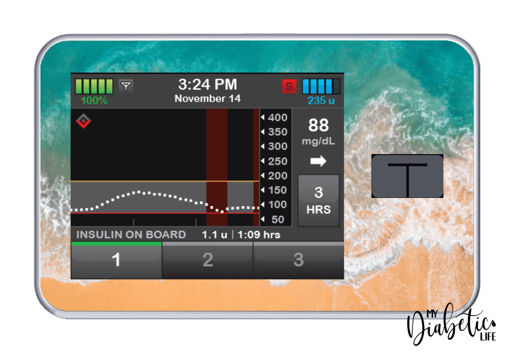 Beaches - Tandem Tslim x2 Pump Peel, skin and Decal, insulin pump sticker - MyDiabeticLife