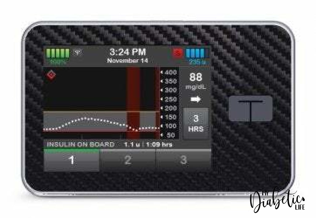 Carbon Fibre - Tandem Tslim x2 Pump Peel, skin and Decal, insulin pump sticker - MyDiabeticLife