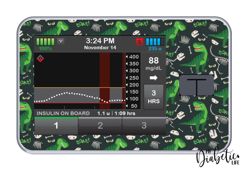 Tandem T:Slim X2 Pump Stickers by My Diabetic Life – MyDiabeticLife