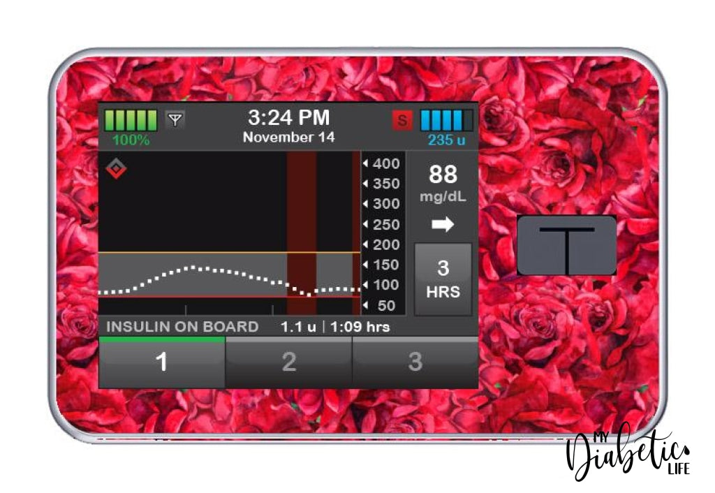 Red Roses - Tandem Tslim X2 Pump Peel Skin And Decal Insulin Pump Sticker T:slim